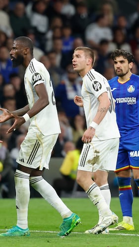 El Real Madrid sigue sufriendo las ausencias de Mbappé