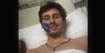 Adriano Malori en el hospital tras ser intervenido. Foto: @Movistar_Team