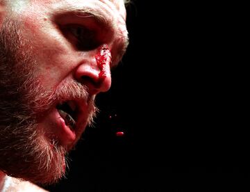 El BKB (Bare-knuckle boxing) es el deporte del boxeo sin el uso de guantes de boxeo u otro acolchado en las manos de los participantes.