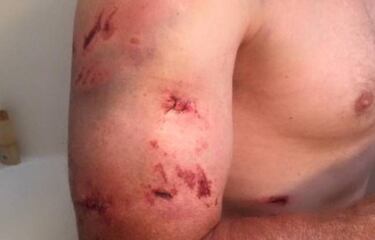 Un hombre se graba despu¨¦s de ser atacado por un oso