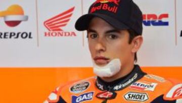 Márquez con un vendaje en su barbilla después de su accidente.