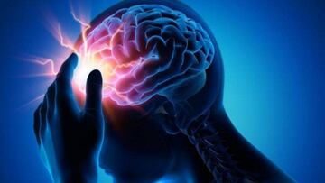 En Colombia, el ACV es la segunda causa de muerte. Foto: Universidad Santo Tomás.