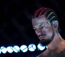 Sean O’Malley se someterá a cirugía de cadera tras perder en el UFC 306 ante Dvalishvili