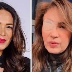 Cuál es la extraña enfermedad que padece Yolanda Andrade