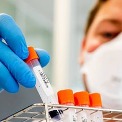 Coronavirus: ¿Por qué se habla del fármaco ivermectina?