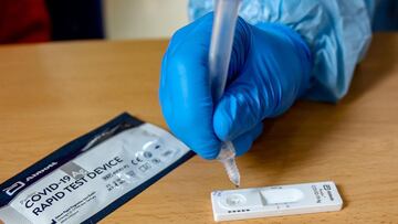 Test de antígenos
RICARDO RUBIO
03/12/2020