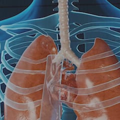 Nueva alerta por extraño virus: Qué es el metapneumovirus humano, síntomas y cuántos casos hay en México