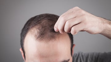 Ni minoxidil ni lociones: este champú con cafeína previene la caída del cabello y arrasa en Amazon España