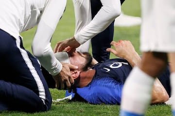 Soccer Football - International Friendly - France vs USA - Groupama Stadium, Lyon, France - June 9, 2018 France's Olivier Giroud receives medical attention REUTERS/Emmanuel Foudrot