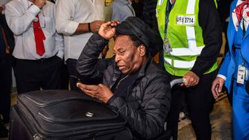 Pelé ha sido operado con éxito de un cálculo renal