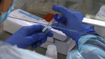 El rebrote y los casos activos actuales en Magallanes preocupan a las autoridades nacionales, sobre todo por una supuesta mutación del virus. ¿Qué pasó?