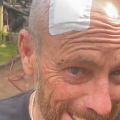 Falsa alarma con Tom Carroll por cuatro puntos en la cabeza