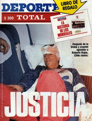 El 3 de septiembre de 1989 la selección chilena se retiró del estadio Maracaná, en el partido ante Brasil. Roberto Rojas se autoinfirió una herida aprovechando la caída de una bengala. El arquero fue suspendido de por vida. Chile fue castigado y no pudo participar en la Copa del Mundo Estados Unidos 1994.