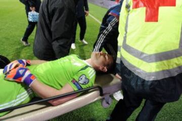 Montenegro-Rusia. Akinfeev, tras recibir el impacto de una bengala en la cabeza, fue retirado en camilla y trasladado al hospital.