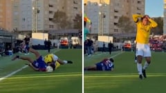 Terrorífica lesión de un jugador del Eldense: se destroza el tobillo completamente
