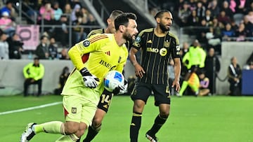 Lloris: “América está arriba de nosotros en calidad, pero podemos igualarlos”