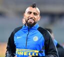 El optimista mensaje de Arturo Vidal tras su operación