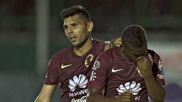 El conjunto de Coapa venció a los Venados de Yucatán por un marcador abultado en su debut de copa.