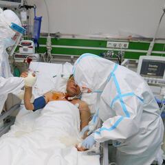 Alertan de una posible epidemia a gran escala con "raras inflamaciones cerebrales"