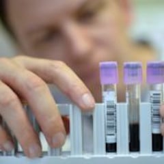 Primer caso de gripe porcina en humanos