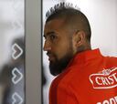 Vidal descarta problema físico: “Quiero jugar contra Rumania”