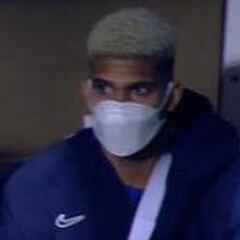 Pesimismo con Araújo: fractura en el metacarpiano de la mano derecha