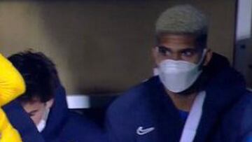 Pesimismo con Araújo: fractura en el metacarpiano de la mano derecha