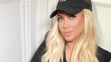 Wanda Nara muestra el resultado de su última operación estética: “Tu bad bitch”