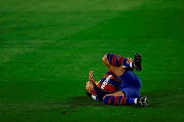 El parte médico ofrecido por el Barcelona exponía lo siguiente: "Las pruebas realizadas en la Ciudad Deportiva Joan Gamper han mostrado que el jugador del primer equipo Ronald Araujo sufre una lesión en el tendón del isquiotibial del muslo derecho.

En los próximos días se someterá a tratamiento quirúrgico a cargo del doctor Lasse Lempainen, bajo la supervisión de los servicios médicos del Club, en Turku (Finlandia). Al finalizar la intervención se facilitará un nuevo parte médico".