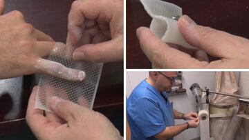 Así se fabrica la férula con la que tendrá que jugar Benzema