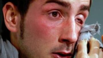 Miki Roqué, baja indefinida por un tumor en la pelvis