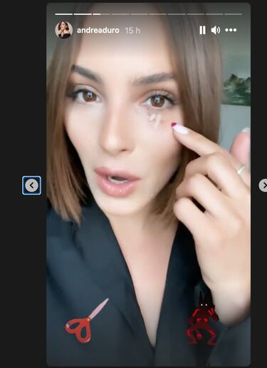 Andrea Duro relata el accidente domstico que casi pone en peligro su ojo