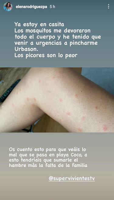 La madre de Adara Molinero, a urgencias tras ¡®Supervivientes¡¯