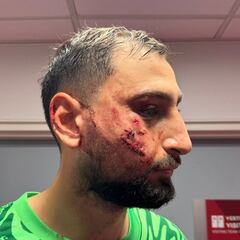 Donnarumma no levanta cabeza