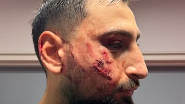 Donnarumma no levanta cabeza