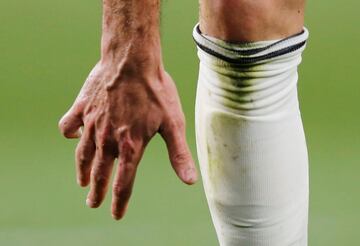 Karim Benzema fue sustituido tras lesionarse el dedo meñique de la  mano derecha.