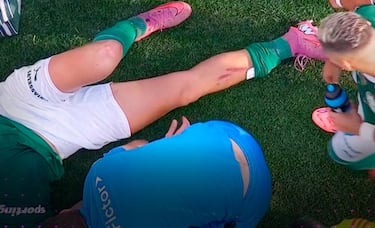 플라멩고와 필립 루이스, 스캔들의 챔피언