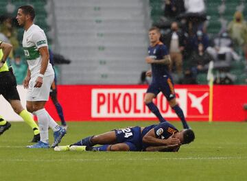 El jugador del Real Madrid ha sufrido una aparatosa caída durante el partido de liga ante el Elche, que le ha supuesto una rotura en la nariz que le hará pasar por el quirófano.