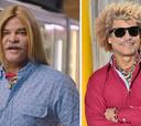 El 'Pibe' Valderrama impacta con un radical cambio de look