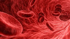 A blow to cholesterol: the novel technique that cleans arteries