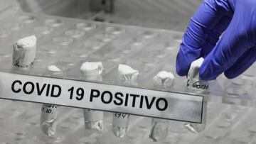 Sigue todo lo relacionado con el coronavirus en vivo y en directo. Casos, noticias y muertes provocadas por el Covid-19 en Colombia el 12 de agosto en AS