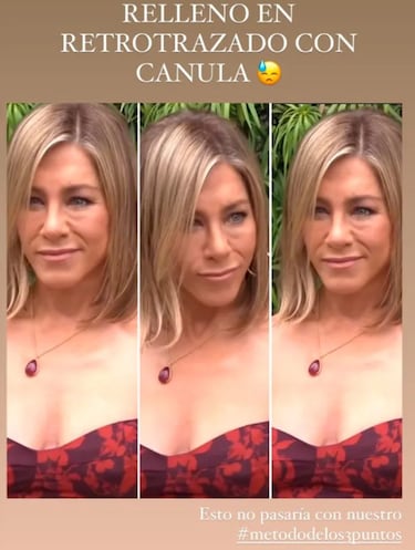 Carla Barber critica el ¨²ltimo retoque est¨¦tico de Jennifer Aniston: ¡°Esto no pasa con mi m¨¦todo¡±