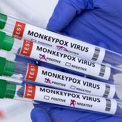 Mpox en México: ¿qué es, cómo se transmite y cuáles son los síntomas?