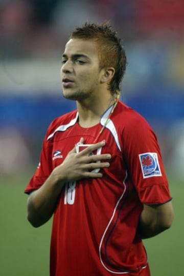 El otrora volante de Unión Española, al igual que Arturo Vidal, se coloró el pelo de rojo en el mundial de Canadá. Este ha sido uno de los tantos looks del ex seleccionado.