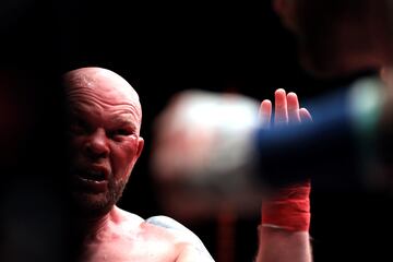 El BKB (Bare-knuckle boxing) es el deporte del boxeo sin el uso de guantes de boxeo u otro acolchado en las manos de los participantes.