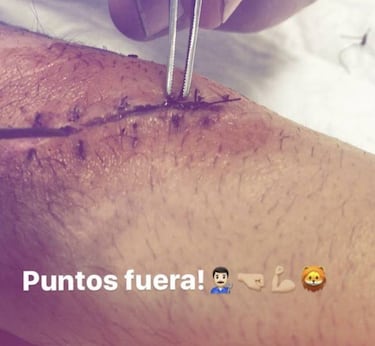 Marc Bartra ense?a las heridas que le dej el atentado