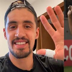 Josecarlos Van Rankin causa baja con Santos Laguna por lesión en el dedo gordo