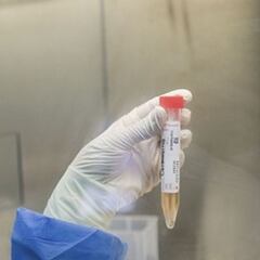 Variante Delta en Lima: qué se sabe y casos confirmados