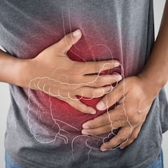 Descubren un gen clave en el avance del cáncer de colon