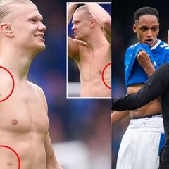 Las heridas de Haaland que indignaron a Guardiola